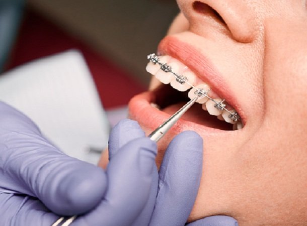 Melbourne Orthodontist